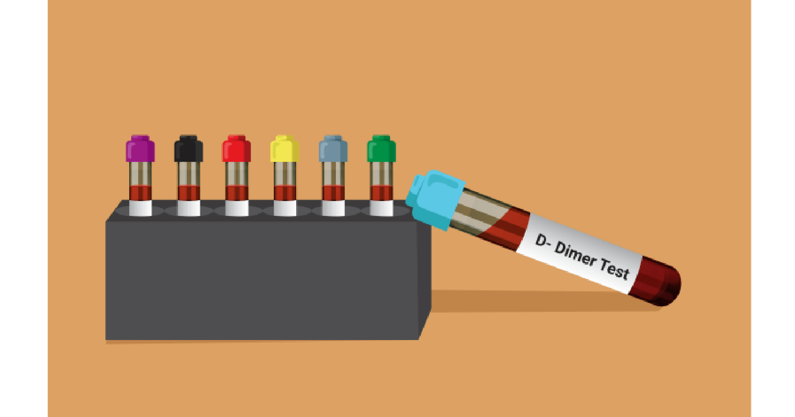 Overview Of The Ddimer Test Uses, Preparation And Risks